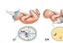 Второй скрининг при беременности: сроки проведения, что смотрят и нормы Скрининг 2 триместра подготовка